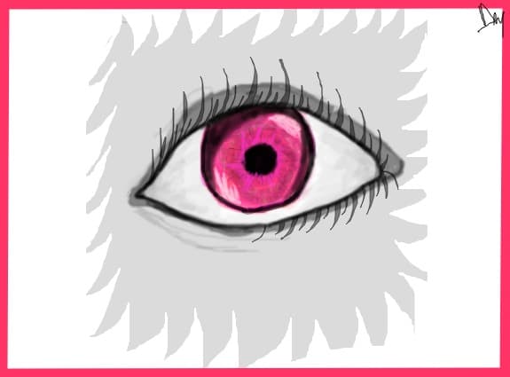 Pink Eye...