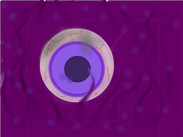 Eye