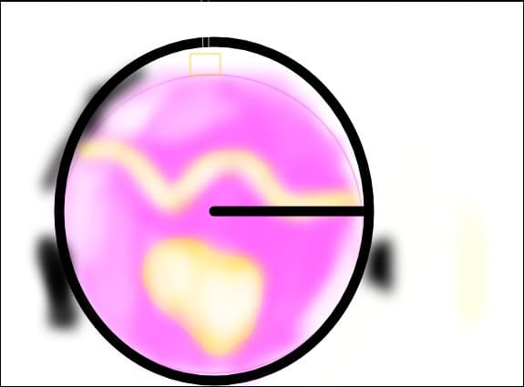 glob