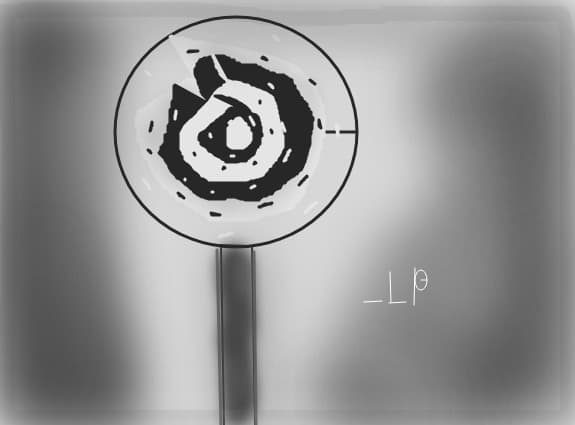 lollipop