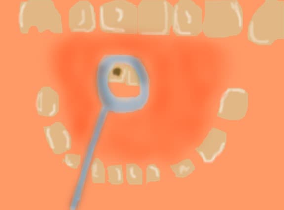 nu suport s merg la dentist