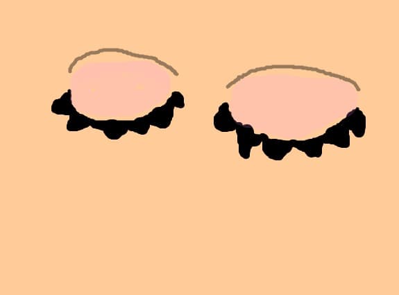 EYE