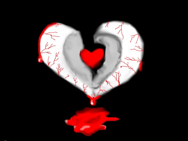 broken heart