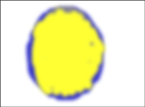 Globulet