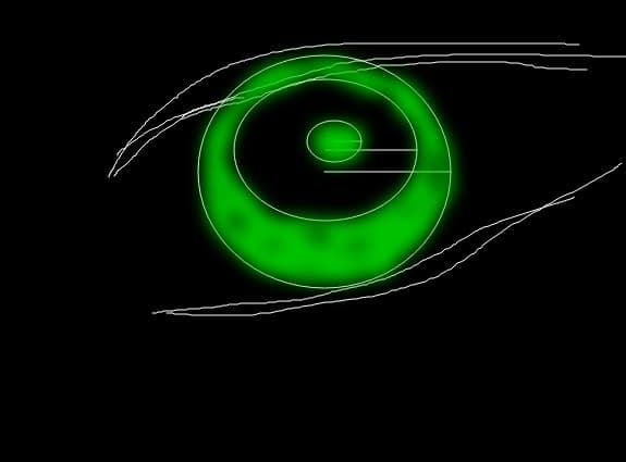 Cornelia\'s sign