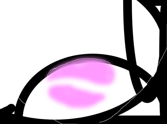 Will\'s sign