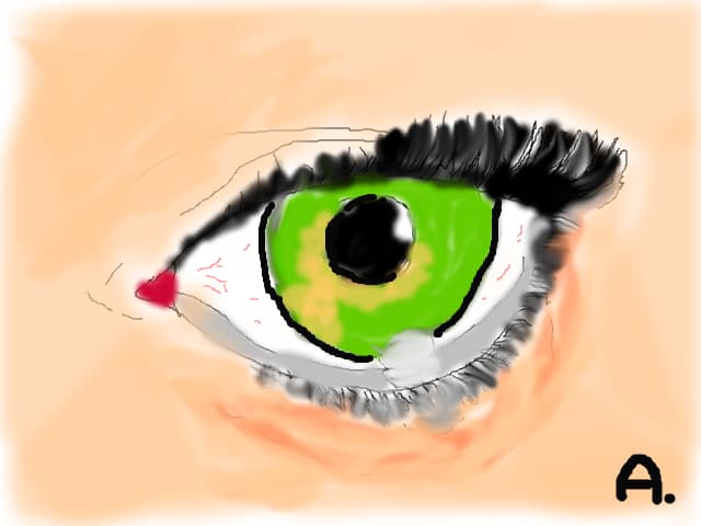 Eyes