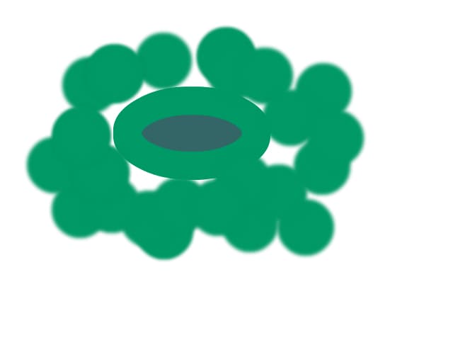 Eye