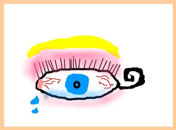 Eye