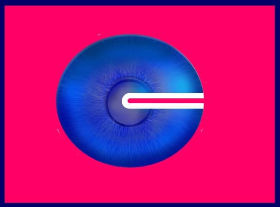 The eye