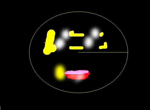Kiss