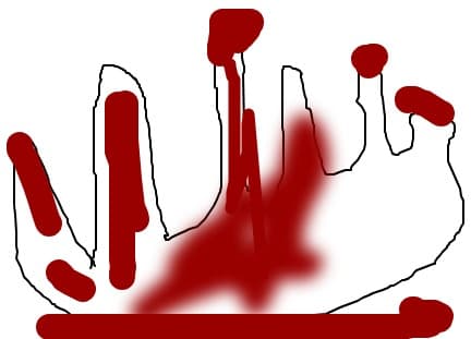 Bloody hand