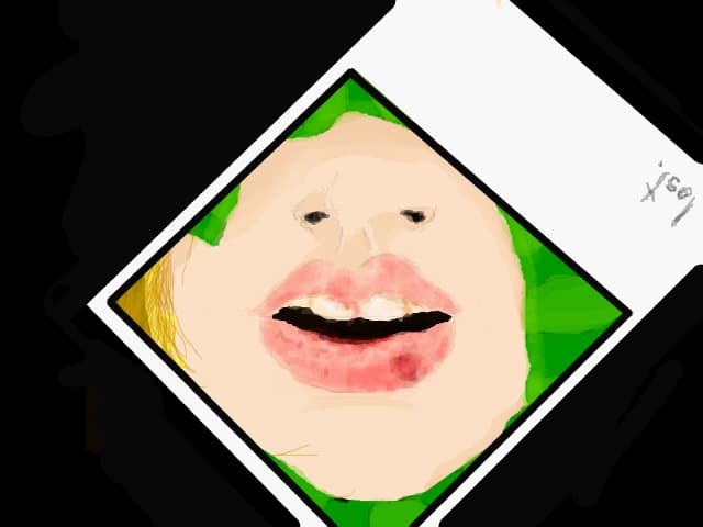 Lips