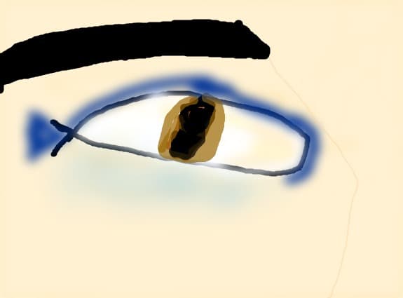 OCHI