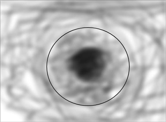 black hole