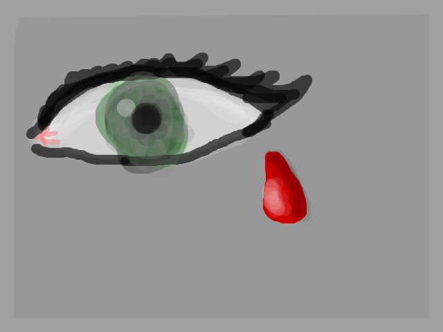 Tears of blood