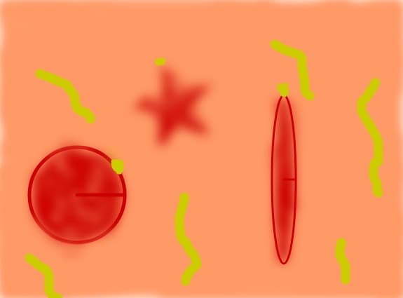 globuri
