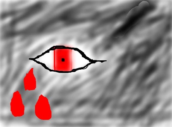 Bloody Eye