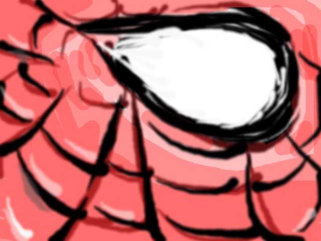 Marvel