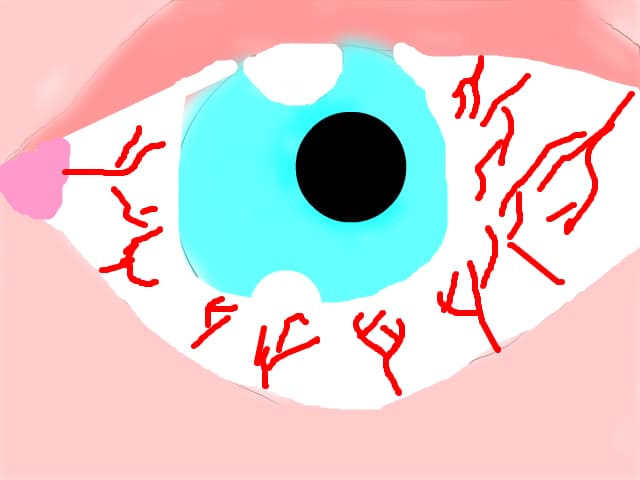 ochi