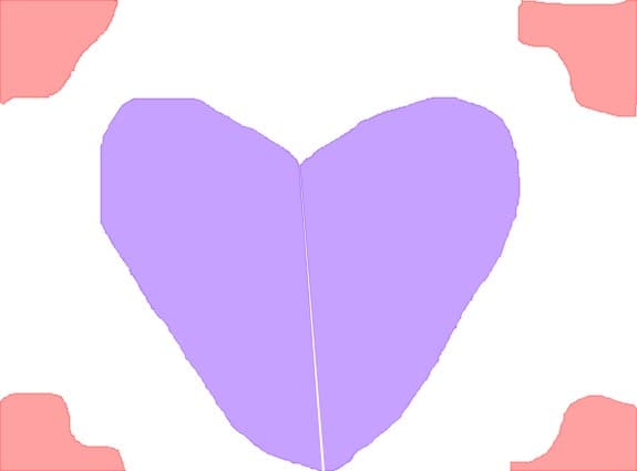 inimioarea
