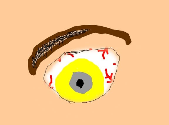 a eye