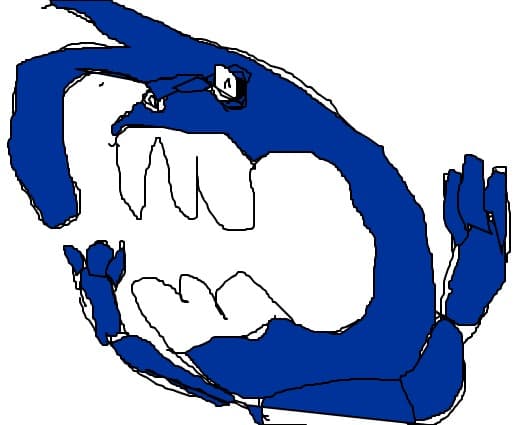 boni