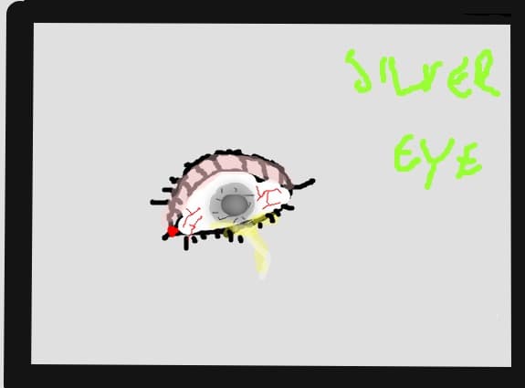 silver eye
