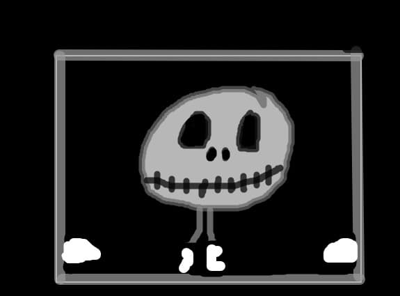 Jack