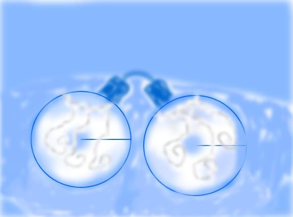 globulete se vede de 100 de ori mai bine mai mare