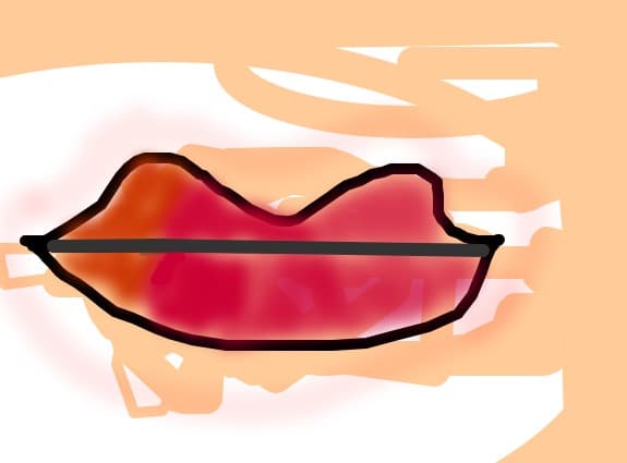 kiss