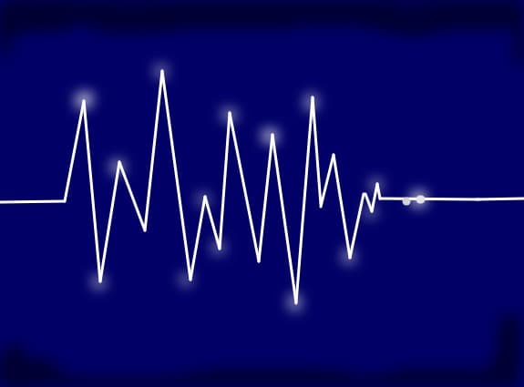 Pulse