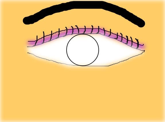 Ochi