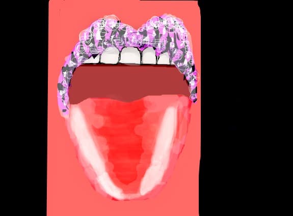 lips sau buze cum vreti voi