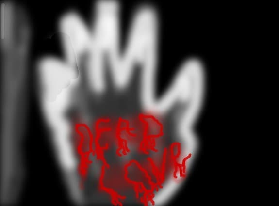 Dead Love