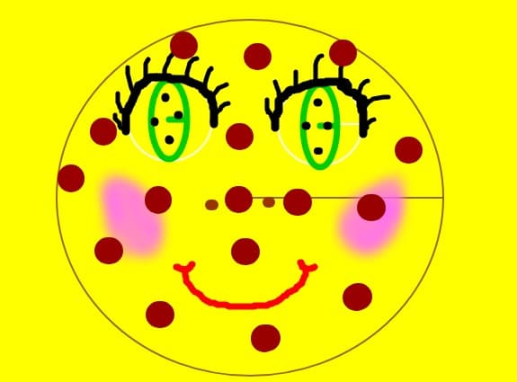 Un fursec vesel