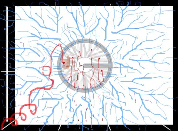 My eye