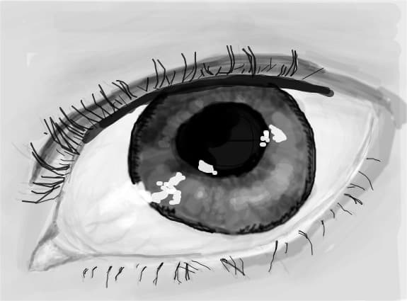 Ugly eye.. :(