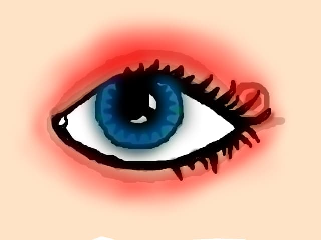 ANPIC