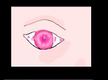 pink eye...